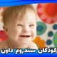 سندروم داون در کودکان