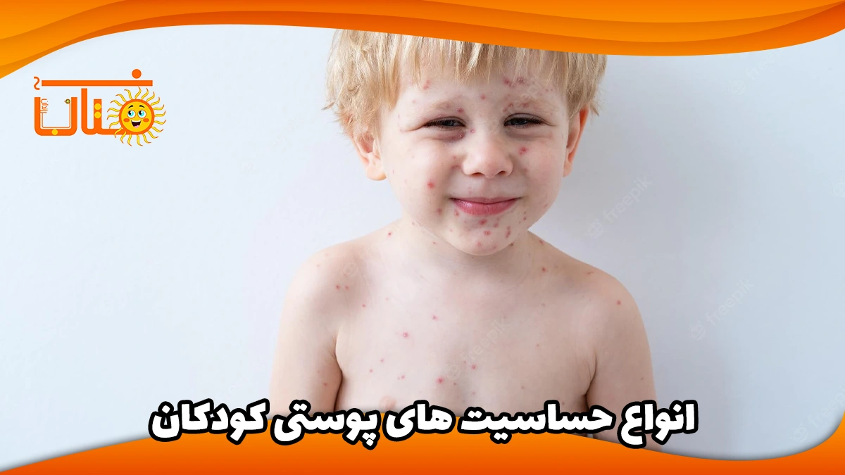 بیماری های پوستی در کودکان