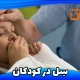 سل در کودکان