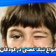 تیک عصبی در کودکان